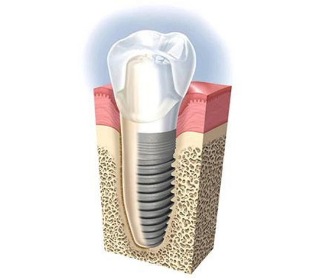 CEOP - Centro de Especialidades Odontológicas Premium implante